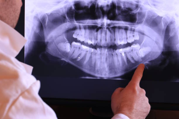 Best Emergency Dental Care for Broken or Chipped Teeth in Underwood, IA