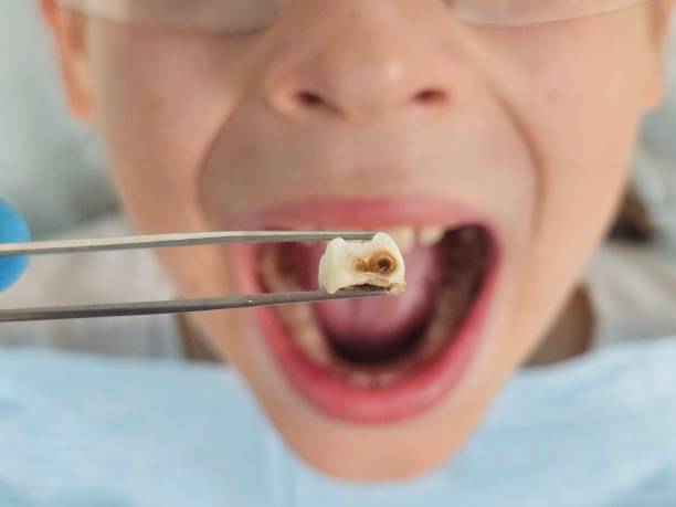Best After-Hours Dental Trauma Care in Underwood, IA